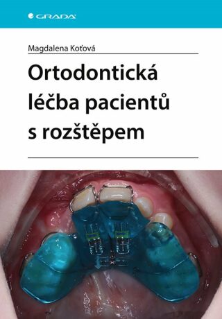Ortodontická léčba pacientů s rozštěpem - Magdalena Koťová
