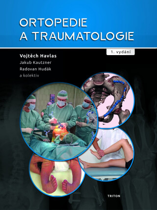 Ortopedie a traumatologie - Josef Kautzner,Radovan Hudák,Vojtěch Havlas
