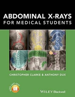 Abdominal X-Rays for Medical Students - Clarke Christopher