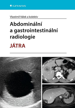 Abdominální a gastrointestinální radiologie - Vlastimil Válek,kolektiv autorů