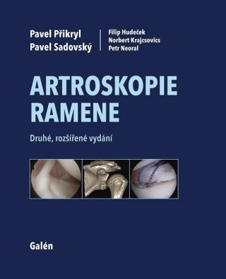 Artroskopie ramene - Pavel Přikryl,Sadovský Pavel,Hudeček Filip,Krajcsovics Norbert,Neoral Petr