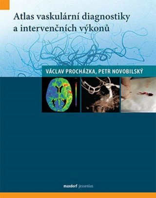 Atlas vaskulární diagnostiky a intervenčních výkonů - Václav Procházka,Novobilský Petr