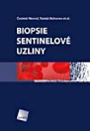 Biopsie sentinelové uzliny - Čestmír Neoral,Tomáš Bohanes