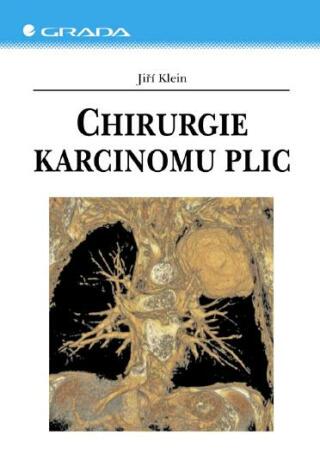 Chirurgie karcinomu plic - Jiří Klein