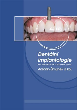 Dentální implantologie - kolektiv autorů,Antonín Šimůnek