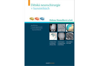 Dětská neurochirurgie v kazuistikách - Homolková Helena