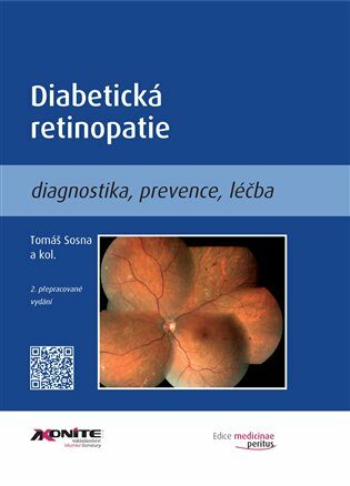 Diabetická retinopatie - Tomáš Sosna