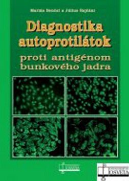Diagnostika autoprotilátok proti antigénom bunkového jadra - Marián Benčat,Július Rajčáni