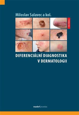 Diferenciální diagnostika v dermatologii - Miloslav Salavec