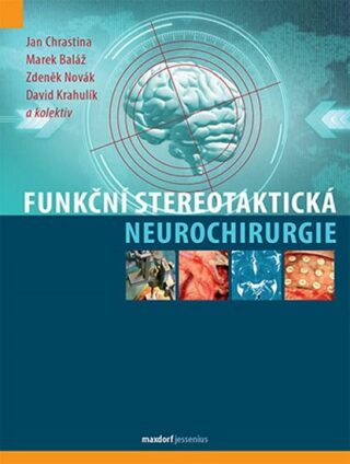 Funkční stereotaktická neurochirurgie - Zdeněk Novák,Jan Chrastina,Baláž Marek,Krahulík David