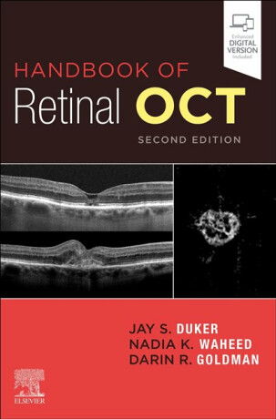 Handbook of Retinal OCT: Optical Coherence Tomography - Darin  Goldman,Nadia K.  Waheed,Jay S., MD  Duker