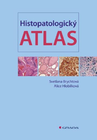 Histopatologický atlas - Svetlana Brychtová,Alice Hlobilková