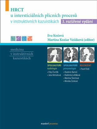 HRCT u intersticiálních plicních procesů v instruktivních kazuistikách - Eva Kočová,Martina Koziar Vašáková
