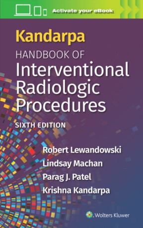 Kandarpa Handbook of Interventional Radiologic Procedures: Print + eBook with Multimedia - KRISHNA KANDARPA,Robert Lewandowski,Parag Patel,Lindsay Machan