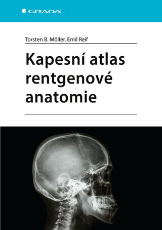 Kapesní atlas rentgenové anatomie - Torsten B. Möller,Emil Reif