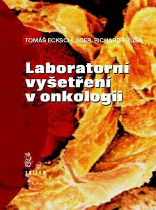 Laboratorní vyšetření v onkologii - Richard Průša