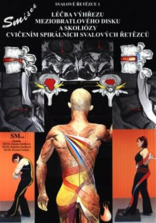 Léčba výhřezu meziobratlového disku bez operace - Richard Smíšek,Kateřina Smíšková,Zuzana Smíšková