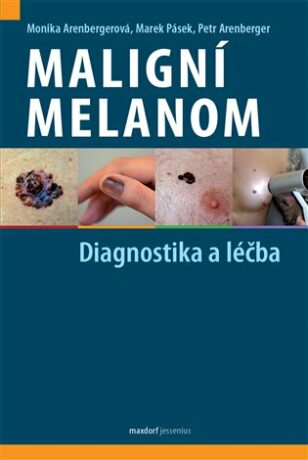 Maligní melanom - Diagnostika a léčba - Petr Arenberger,Monika Arenbergerová,Marek Pásek