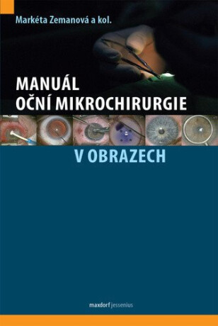 Manuál oční mikrochirurgie v obrazech - kolektiv autorů,Markéta Zemanová