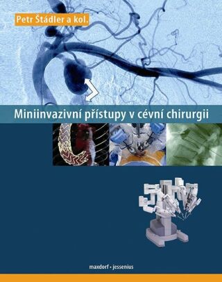 Miniinvazivní přístupy v cévní chirurgii - Petr Štádler