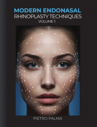 Modern Endonasal Rhinoplasty Techniques â€“ Volume 1 - Pietro Palma