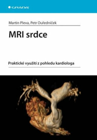MRI srdce - praktické využití z pohledu - Pleva Martin,Petr Ouředníček