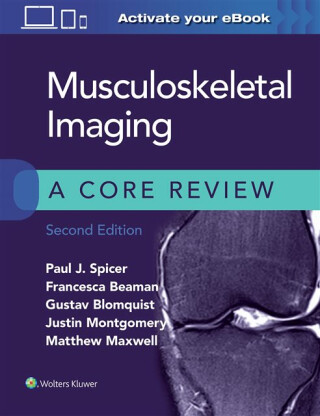 Musculoskeletal Imaging: A Core Review - Paul Spicer,Francesca Beaman,Matthew Maxwell,Justin Montgomery,Gustav Blomquist