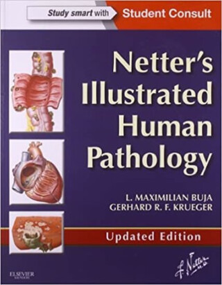 Netter's Illustrated Human Pathology Updated Edition - Gerhard R. F., MD, PhD  Krueger,L. Maximilian, M.D.  Buja