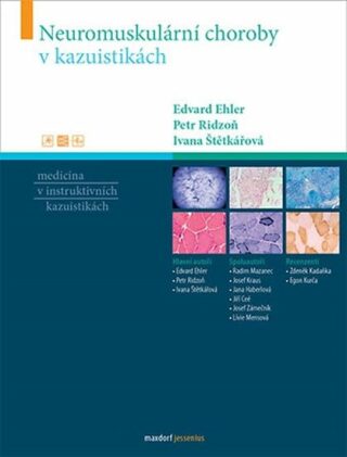 Neuromuskulární choroby v kazuistikách - Ivana Štětkářová,Edvard Ehler,Petr  Ridzoň