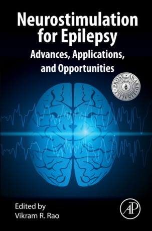 Neurostimulation for Epilepsy - 