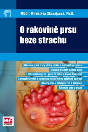 O rakovině prsu beze strachu - Miroslava Skovajsová