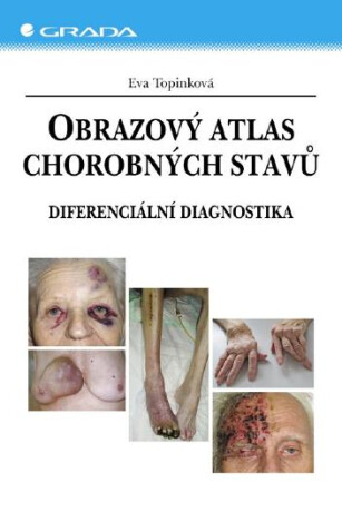Obrazový atlas chorobných stavů - Eva Topinková
