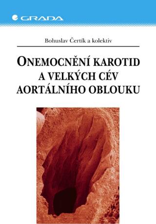 Onemocnění karotid a velkých cév aortálního oblouku - Bohuslav Čertík,kolektiv a