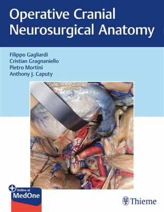 Operative Cranial Neurosurgical Anatomy - Anthony J. Caputy,Pietro Mortini,Filippo Gagliardi,Cristian Gragnaniello