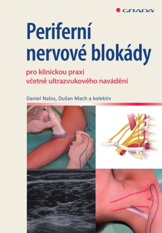 Periferní nervové blokády - kolektiv a,Daniel Nalos,Dušan Mach