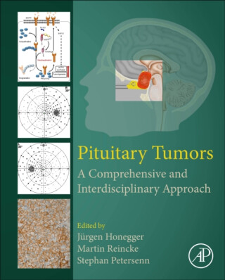 Pituitary Tumors - 