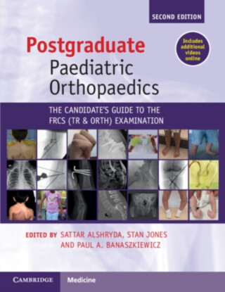 Postgraduate Paediatric Orthopaedics - 