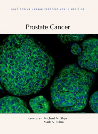 Prostate Cancer - Mark Rubin,Michael Shen