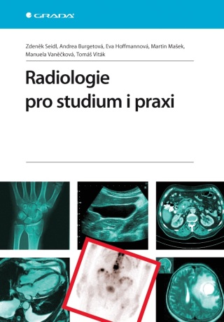 Radiologie pro studium i praxi - Zdeněk Seidl,Andrea Burgetová,Eva Hoffmannová,Martin Mašek,Manuela Vaněčková,Tomáš Viták