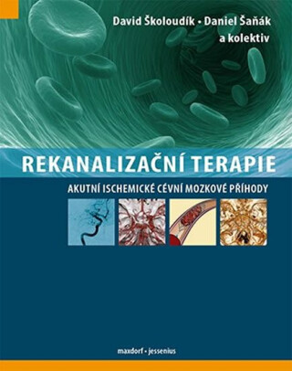 Rekanalizační terapie - Akutní ischemické cévní mozkové příhody - kolektiv autorů,David Školoudík