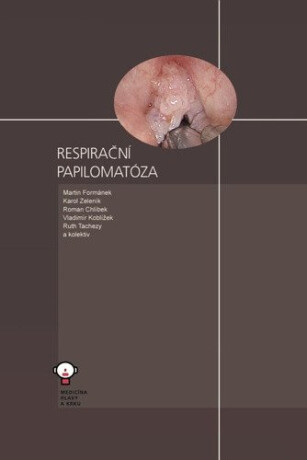 Respirační papilomatóza - Vladimír Koblížek,kolektiv autorů,Roman Chlíbek,Martin Formánek,Karol Zeleník,Ruth Tachezy