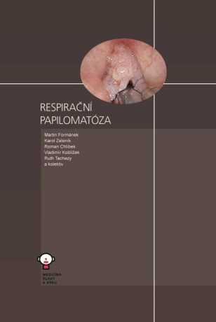Respirační papilomatóza - Roman Chlíbek,Martin Formánek,Karol Zeleník