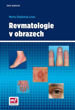 Revmatologie v obrazech - Mudr. Marta Olejárová