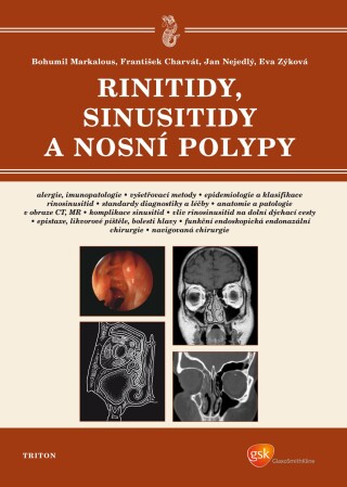 Rinitidy, sinusitidy a nosní polypy - Bohumil Markalous,Jan Nejedlý,František Charvát,Eva Zýková