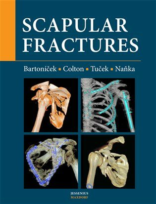 Scapular fractures - Jan Bartoníček,Ondřej Naňka,Michal  Tuček,Christopher Colton