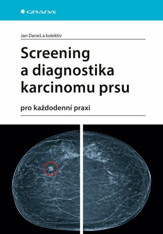 Screening a diagnostika karcinomu prsu - kolektiv a,Jan Daneš