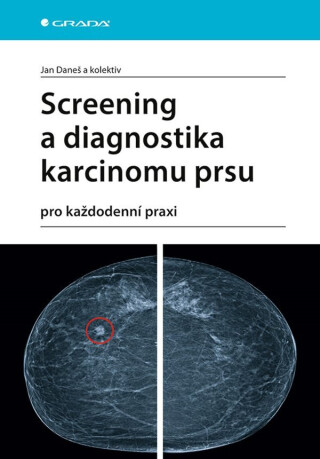 Screening a diagnostika karcinomu prsu pro každodenní praxi (poškozené) - Jan Daneš