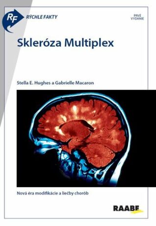 Skleróza Multiplex - Gabrielle Macaron,Stella E. Hughes