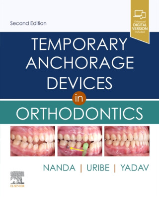 Temporary Anchorage Devices in Orthodontics - 
