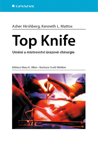 Top Knife - Asher Hirshberg,Kenneth L. Mattox